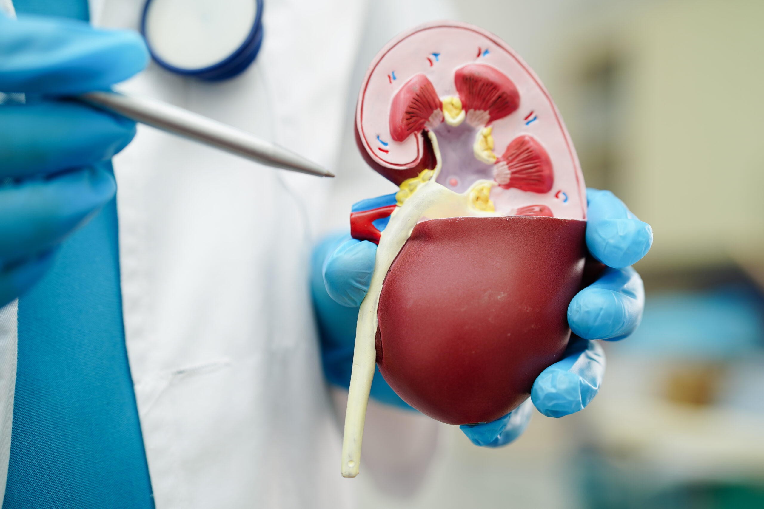 Kidney Cancer