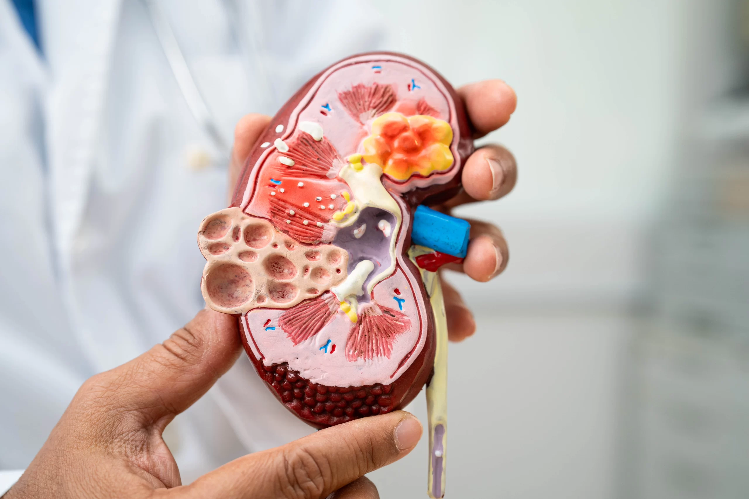 Kidney Disease