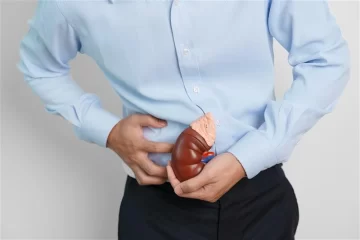 Kidney stones